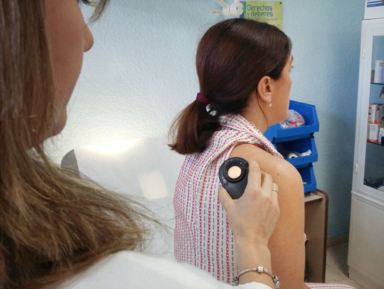 Imagen de una paciente en la consulta de Dermatología, donde se analiza una lesión de la piel sospechosa de malignidad. 